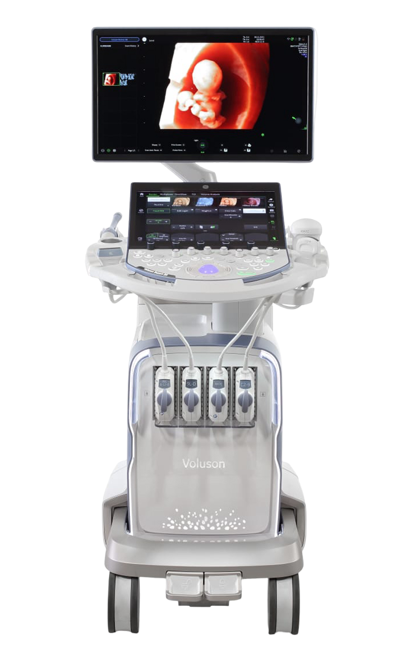 AI-Powered Ultrasound System in Guntur